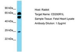 Image no. 1 for anti-CD200 Receptor 1-Like (CD200R1L) (AA 87-136) antibody (ABIN6750795) (CD200R1L anticorps  (AA 87-136))