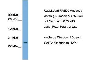 WB Suggested Anti-RAB35  Antibody Titration: 0. (RAB35 anticorps  (Middle Region))