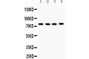 Western Blotting (WB) image for anti-Protein Kinase C, alpha (PKCa) (AA 153-342) antibody (ABIN3043549) (PKC alpha anticorps  (AA 153-342))
