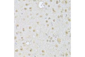Immunohistochemistry of paraffin-embedded rat brain using HDAC3 Antibody (ABIN1872955) at dilution of 1:100 (40x lens). (HDAC3 anticorps)
