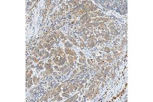 IHC analysis of SNPH using anti-SNPH antibody (ABIN7601724). (Syntaphilin anticorps  (AA 43-482))