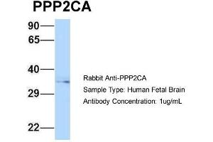 Host: Rabbit  Target Name: PPP2CA  Sample Tissue: Human Fetal Brain  Antibody Dilution: 1. (PPP2CA anticorps  (N-Term))