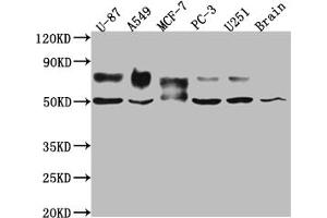 Western Blot Positive WB detected in: U-87 whole cell lysate, A549 whole cell lysate, MCF-7 whole cell lysate, PC-3 whole cell lysate, U-251 whole cell lysate, Mouse Brain whole cell lysate All lanes: 5T4 antibody at 1:1000 Secondary Goat polyclonal to rabbit IgG at 1/50000 dilution Predicted band size: 47 kDa Observed band size: 50, 80 kDa (Recombinant TPBG anticorps)