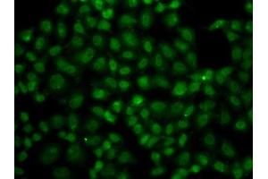 Immunofluorescence analysis of A549 cells using USP26 antibody. (USP26 anticorps  (AA 664-913))