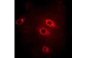 Immunofluorescent analysis of 14-3-3 beta staining in Hela cells.