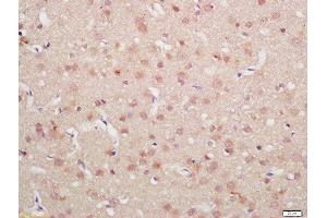 Formalin-fixed and paraffin embedded rat brain labeled with Rabbit Anti-MDM2(Ser186) Polyclonal Antibody, Unconjugated  at 1:200 followed by conjugation to the secondary antibody and DAB staining (MDM2 anticorps  (pSer186))