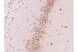 Paraformaldehyde-fixed, paraffin embedded rat brain; Antigen retrieval by boiling in sodium citrate buffer (pH6) for 15min; Block endogenous peroxidase by 3% hydrogen peroxide for 30 minutes; Blocking buffer (normal goat serum) at 37°C for 20min; Antibody incubation with PTPN5/STEP Polyclonal Antibody, Unconjugated (bs-11328R) at 1:200 overnight at 4°C, followed by a conjugated secondary and DAB staining.