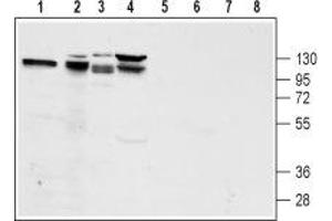 Western blot analysis of rat pancreas lysate (lanes 1 and 5), mouse preadipocyte 3T3-L1 lysate (lanes 2 and 6), rat pancreatic islet cell line RIN-5F lysate (lanes 3 and 7) and human pancreatic carcinoma PANC-1 lysate (lanes 4 and 8): - 1-4. (GLP1R anticorps  (2nd Extracellular Loop))