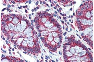 Colon, Human: Formalin-Fixed, Paraffin-Embedded (FFPE) (PGLS anticorps  (C-Term))