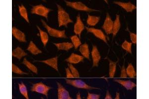 Immunofluorescence analysis of L929 cells using KIF13A Polyclonal Antibody at dilution of 1:100. (KIF13A anticorps)