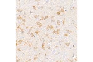 Immunohistochemistry of paraffin-embedded rat brain using eIF1A Rabbit mAb (ABIN7267027) at dilution of 1:50 (40x lens). (Eukaryotic Translation Initiation Factor 1A (EIF1A) anticorps)