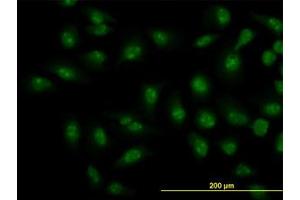 Image no. 4 for anti-SMAD, Mothers Against DPP Homolog 1 (SMAD1) (AA 1-466) antibody (ABIN598792)