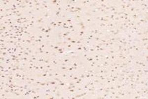 Immunohistochemistry analysis of paraffin-embedded mouse hippocampus using MED3 (ABIN7074581) at dilution of 1: 7200