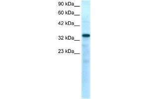 WB Suggested Anti-TBX10 Antibody Titration:  0.