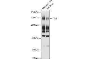 Western blot analysis of extracts of various cell lines, using TrkB antibody (ABIN3022911, ABIN3022912, ABIN3022913 and ABIN6219292) at 1:1000 dilution. (TRKB anticorps  (AA 32-282))