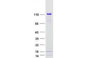 Validation with Western Blot