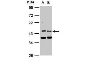 WB Image Sample(30 ug whole cell lysate) A:HeLa S3, B:MOLT4 , 10% SDS PAGE antibody diluted at 1:1000 (PDK1 anticorps)