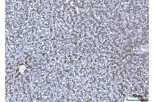 IHC analysis of GLUD1/2 using anti-GLUD1/2 antibody (ABIN7602000). (GLUD1 / GLUD2 (AA 54-553) anticorps)