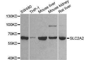 Western blot analysis of extracts of various cell lines, using SLC2A2 antibody. (SLC2A2 anticorps)