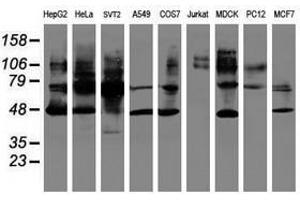 Image no. 2 for anti-serpin Peptidase Inhibitor, Clade B (Ovalbumin), Member 1 (SERPINB1) (AA 77-306) antibody (ABIN1491672) (SERPINB1 anticorps  (AA 77-306))