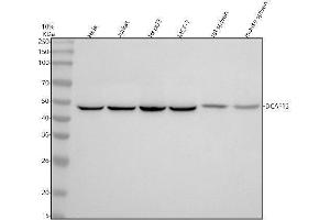 Western blot analysis of DCAF13 using anti-DCAF13 antibody (ABIN7604612).