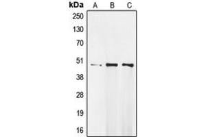 Western blot analysis of MOK expression in Raji (A), MDAMB231 (B), A549 (C) whole cell lysates. (MOK anticorps  (Center))