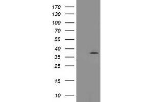 Western Blotting (WB) image for anti-Translocase of Outer Mitochondrial Membrane 34 (TOMM34) antibody (ABIN1501469) (TOMM34 anticorps)