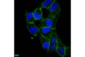 Immunofluorescence staining of Hela cells with ABIN7127287 at 1:87. (Recombinant CD97 anticorps)