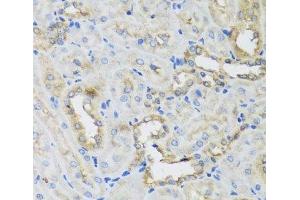Immunohistochemistry of paraffin-embedded Rat kidney using AHCYL1 Polyclonal Antibody at dilution of 1:100 (40x lens). (AHCYL1 anticorps)