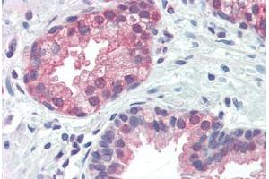 anti-BCL2/adenovirus E1B 19kDa Interacting Protein 3 (BNIP3) (AA 112-124) antibody