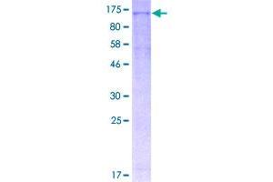 Image no. 1 for NLR Family, Pyrin Domain Containing 3 (NLRP3) (AA 1-1036) protein (GST tag) (ABIN1312675)