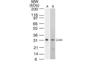 Livin BIRC7 KIAP Western Blot. (BIRC7 anticorps)