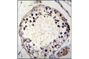 Immunohistochemistry analysis in formalin fixed and paraffin embedded human testis tissue stained with PTCHD3 Antibody (C-term)  followed by peroxidase conjugation of the secondary antibody and DAB staining.