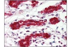 Immunohistochemistry (IHC) image for anti-Programmed Cell Death 4 (PDCD4) (AA 1-469), (N-Term) antibody (ABIN317548) (PDCD4 anticorps  (N-Term))