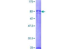 Image no. 1 for Protoporphyrinogen Oxidase (PPOX) (AA 1-477) protein (GST tag) (ABIN1315933)