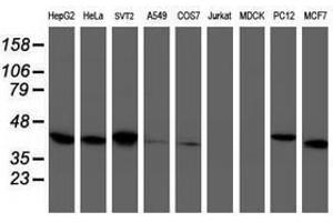 Image no. 7 for anti-Tubulin Folding Cofactor C (TBCC) antibody (ABIN1501323)