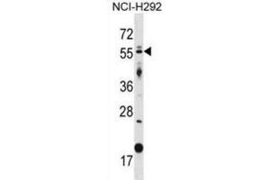 Western Blotting (WB) image for anti-GLIS Family Zinc Finger 2 (GLIS2) antibody (ABIN2998792) (GLIS2 anticorps)