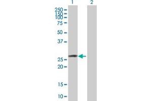 Western Blot analysis of OSTF1 expression in transfected 293T cell line by OSTF1 MaxPab polyclonal antibody. (OSTF1 anticorps  (AA 1-217))