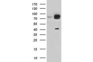 Western Blotting (WB) image for anti-Kelch Repeat and BTB (POZ) Domain Containing 7 (KBTBD7) antibody (ABIN1498995) (KBTBD7 anticorps)