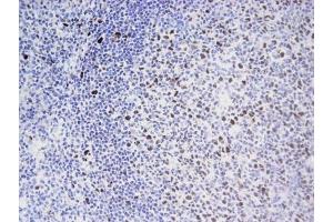 EED mAb tested by Immunohistochemistry .