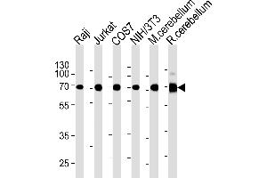 ACHE Antibody (C-term) (ABIN1882203 and ABIN2838474) western blot analysis in Raji,Jurkat,COS7,mouse NIH/3T3 cell line and mouse cerebellum,rat cerebellum tissue lysates (35 μg/lane). (Acetylcholinesterase anticorps  (C-Term))