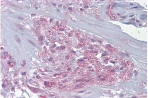 Immunohistochemistry with Small intestine, myetneric plexus tissue at an antibody concentration of 5-10µg/ml using anti-FREQ antibody (ARP34711_P050)