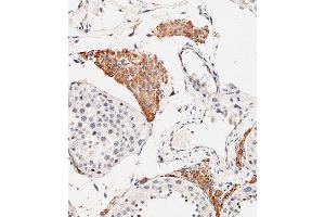 Immunohistochemical analysis of paraffin-embedded human testis tissue using C performed on the Leica® BOND RXm.