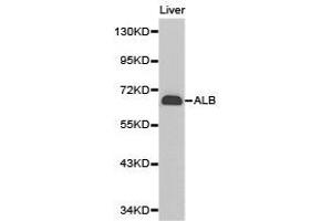 Western Blotting (WB) image for anti-Albumin (ALB) antibody (ABIN2650895) (Albumin anticorps)