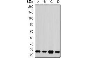 Western blot analysis of PSMA2 expression in Jurkat (A), Hela (B), NIH3T3 (C), mouse brain (D) whole cell lysates. (PSMA2 anticorps)