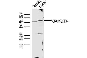 Lane 1: Mouse brain lysates, Lane 2: Mouse bone lysates probed with SAMD14 Polyclonal Antibody, unconjugated  at 1:300 overnight at 4°C followed by a conjugated secondary antibody at 1:10000 for 60 minutes at 37°C. (SAMD14 anticorps  (AA 231-330))