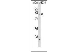 Western blot analysis of FZD2 / Frizzled-2 Antibody (C-term) in MDA-MB231 cell line lysates (35ug/lane). (FZD2 anticorps  (C-Term))