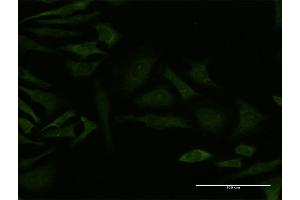 Immunofluorescence of monoclonal antibody to GRK4 on HeLa cell.