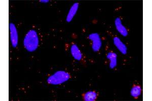Proximity Ligation Analysis of protein-protein interactions between WNT5A and FZD5.