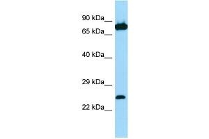 Host: Rabbit Target Name: SNX27 Sample Type: Jurkat Whole Cell lysates Antibody Dilution: 1. (SNX27 anticorps  (C-Term))